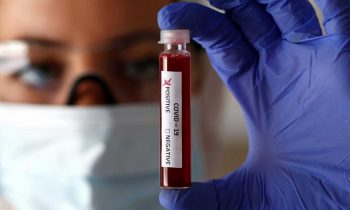 El estudio de prevalencia del coronavirus tendrá en cuenta la discapacidad