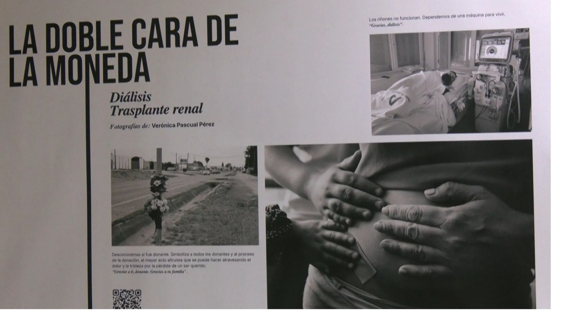 El Hospital Puerta del Mar acoge una exposición sobre pacientes renales en Cádiz